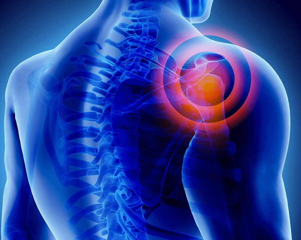 shoulder-surgery-image