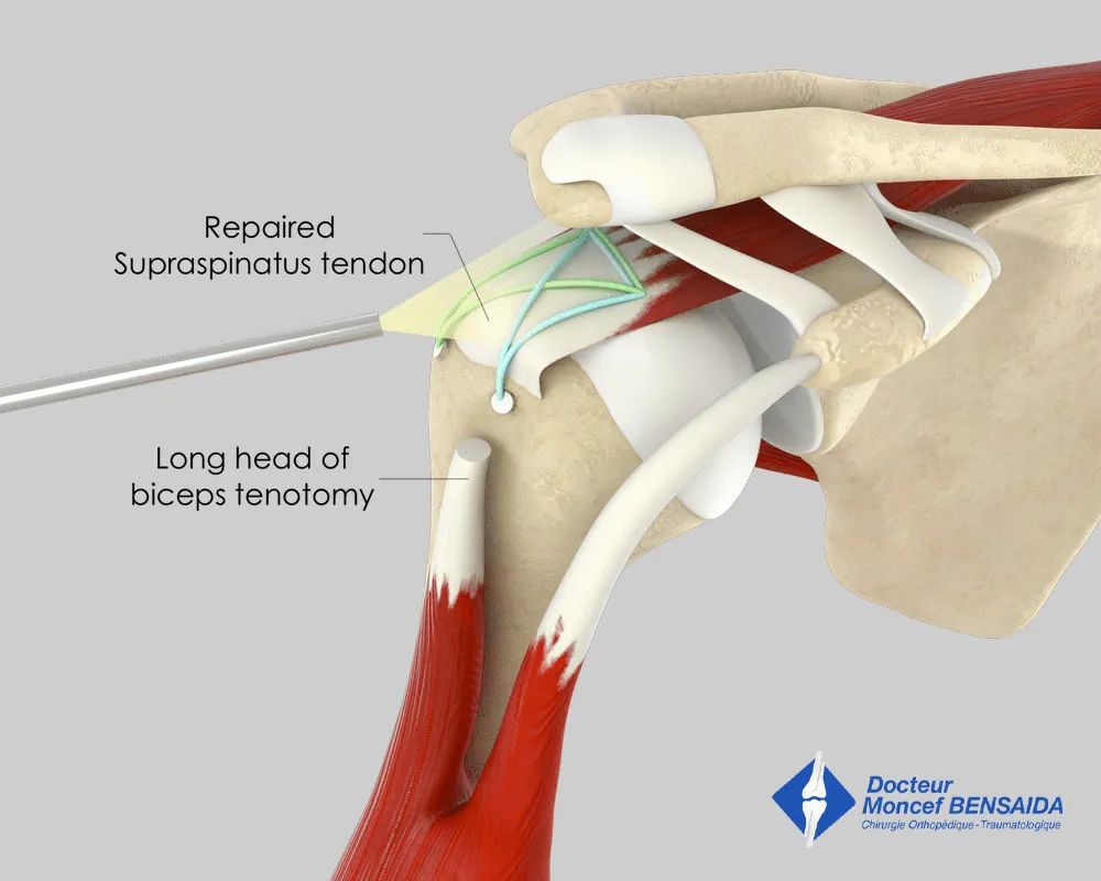 Final appearance of the repair