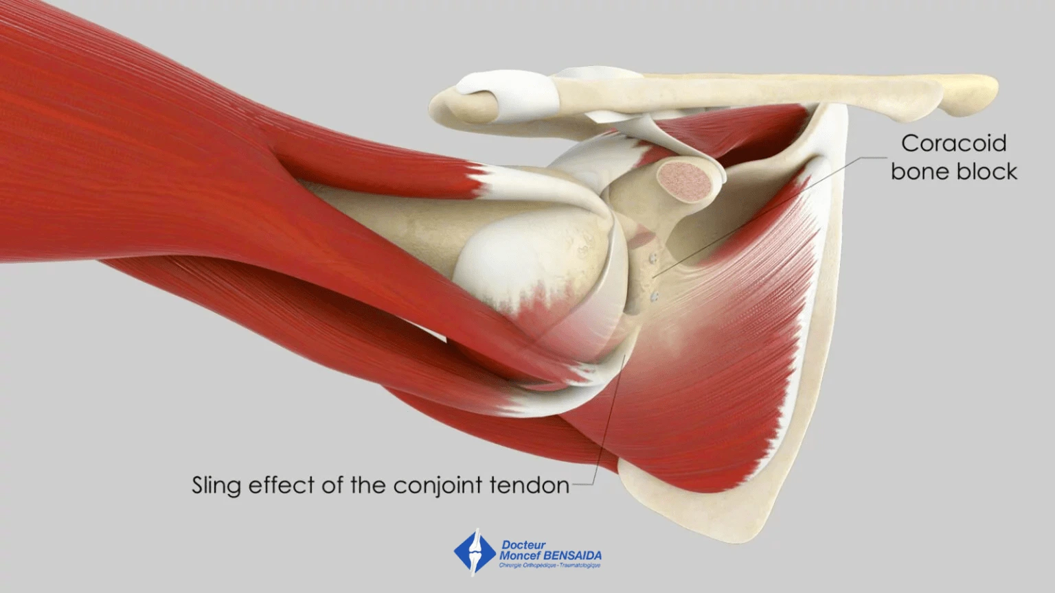 Sling effect providing stabilisation when cocking the arm